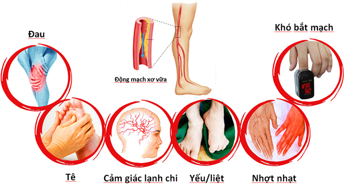 Máu nhiễm mỡ có nguy hiểm không